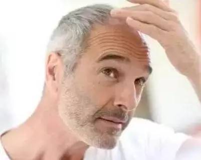 吃核桃能治白头发吗
