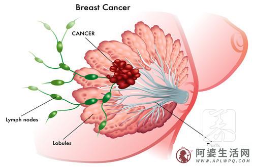 乳腺包块怎样保守治疗