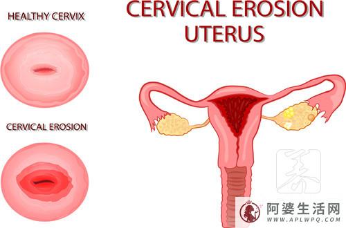 宫腹腔镜手术后10天菜谱