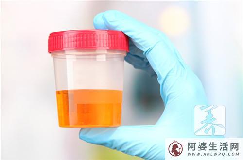 孕妇24钟头蛋白尿参照范畴 