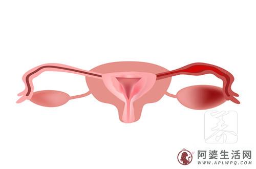 输卵管堵塞会有什么症状？