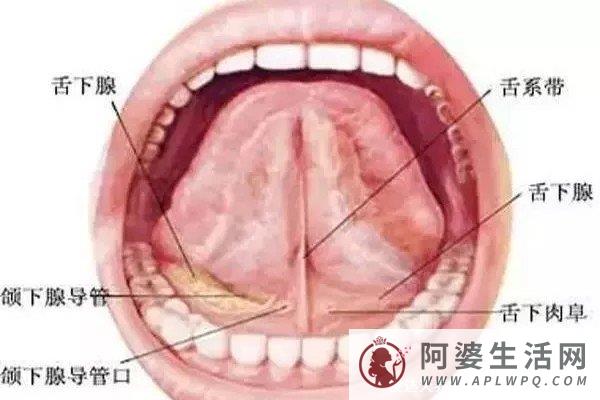 口腔舌系带疣体图片，有数个豆大菜花状疣体(声音可能会嘶哑)