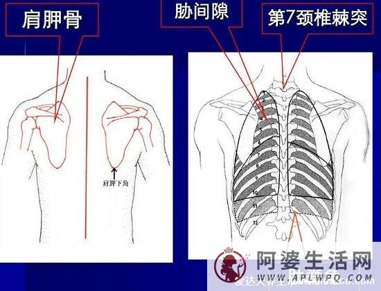 肾结石会引起身体哪个部位疼痛图片，腹痛/腰痛(肾疼腰疼区别图)