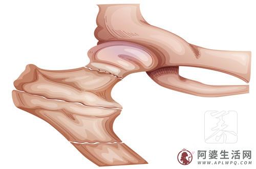 骨盆矫正需要多少钱