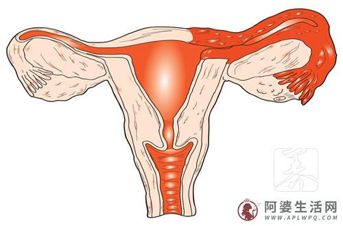  右侧卵巢多囊能治好吗